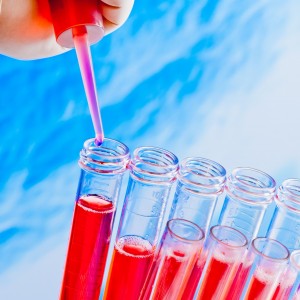 test tubes being used for lab tests